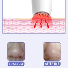 Load image into Gallery viewer, 6 In 1 RF Face Massager Skin Rejuvenation Facial Mesotherapy Lifting Beauty Vibration Wrinkle Removal Anti Aging Radio Frequency
