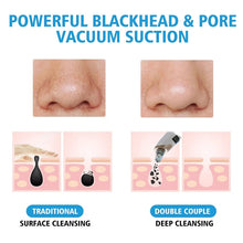 Load image into Gallery viewer, Electric Facial Blackhead Remover Vacuum Acne Spots Pore Black Dot Cleaner Pimple Remover Face Deep Cleaning Machine Beauty Tool