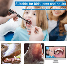 Load image into Gallery viewer, Intraoral Dental Camera Endoscope 720P HD Oral Dental Camera Adjustable 6 LED Light IP67 USB Tooth Camera for PC Laptop Computer