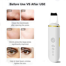 Load image into Gallery viewer, Ultrasonic Skin Scrubber Electric Vibration Deep Face Cleaning Peeling Shovel Facial Pore Cleaner Lifting Massager Beauty Device