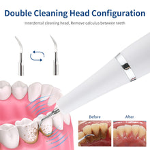 Load image into Gallery viewer, Ultrasonic Tooth Cleaner Electric Dental Calculus Scaler Tartar Remover Plaque Stains Cleaner Teeth Whitening Oral Hygiene Care