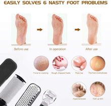 Load image into Gallery viewer, Foot Care Set Pedicure Set Professional Stainless Steel Nail Clipper Callus Remover Manicure Set Foot Care Set for Women Men