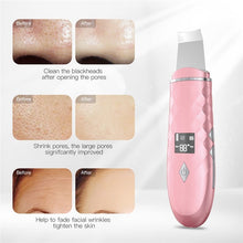 Load image into Gallery viewer, Ultrasonic Skin Scrubber Warmer Facial Cleanser Dirt Blackhead Removal Reduce Wrinkle Spot Face Whitening Lifting Machine