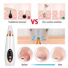 Load image into Gallery viewer, 6 In 1 Electric Facial Blackhead Remover Vacuum Suction Pore Removal Deep Cleaning Face Cleanser Household Beauty Tools