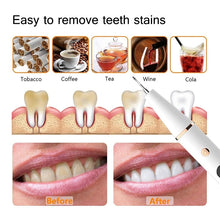 Load image into Gallery viewer, Electric Sonic Dental Calculus Scaler Oral Teeth Irrigator Calculus Remover Plaque Stains Cleaner Teeth Whitening LED Display