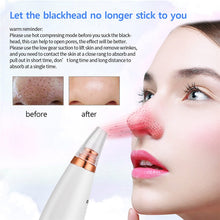 Load image into Gallery viewer, 6 In 1 Electric Facial Blackhead Remover Vacuum Suction Pore Removal Deep Cleaning Face Cleanser Household Beauty Tools