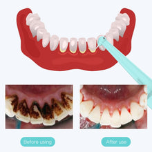 Load image into Gallery viewer, Ultrasonic Dental Washer Portable Dental Scaler USB Rechargeable Dental Calculus Remover for Tartar Clean Teeth Whitening
