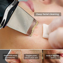 Load image into Gallery viewer, Ultrasonic Skin Scrubber Vibration Facial Deep Cleansing Blackhead Remover Face Peeling Lifting Massage Cleaner Beauty Device