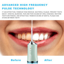 Load image into Gallery viewer, Profession Dental Water Flosser Teeth whitening Electric Irrigator Dental Irrigator Teeth Cleaning Machine Oral Care Tool