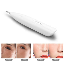 Load image into Gallery viewer, Electric Mini Laser Pen Tattoo Mole Removal Machine Face Care Skin Tag Removal Freckle Wart Dark Sweep Spot Remover Device