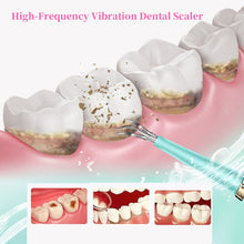 Load image into Gallery viewer, Portable Electric Sonic Dental Scaler Tooth Cleanser Dentist Calculus Stains Tartar Remover Teeth Whitening Tools Oral Hygiene