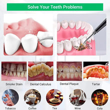 Load image into Gallery viewer, Dental Scaler Ultrasonic Tooth Cleaner Stone Removal Electric Sonic Plaque Remover for Teeth Stain Tartar Calculus whitening