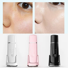 Load image into Gallery viewer, Ultrasonic Skin Scrubber Electric Vibrating Face Spatula Facial Scrubber Shovel Peeling Cleaner Lifting Massager Beauty Device