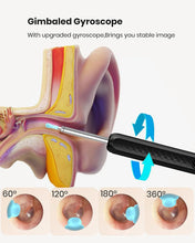 Load image into Gallery viewer, Ear Wax Removal Tool-Spade Ear Cleaner with Ear Camera1296P Ear-Scope Earwax Remover Picker with 6LED Light for Earwax Cleaning