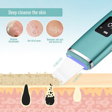 Load image into Gallery viewer, Ultrasonic Skin Scrubber EMS Facial Pore Deep Cleansing Spatula Blackhead Dead Skin Remover Acne Extractor Face Lifting Massager