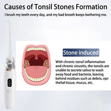 Load image into Gallery viewer, Electric Tonsil Stone Remover Tonsil Stone Removal Kit Vacuum With Irrigation Syringe Instant Suction Tonsil Stone Removal
