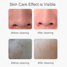 Load image into Gallery viewer, Ultrasonic Skin Scrubber Electric Facial Cleansing Pore Deep Clean Acne Blackhead Remover Peeling Shovel Beauty Machine
