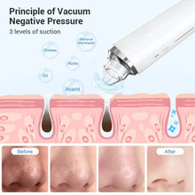 Load image into Gallery viewer, Electric Blackhead Remover Vacuum Acne Cleaner Black Spots Removal Facial Deep Cleansing Pore Cleaner Machine Skin Care Tools