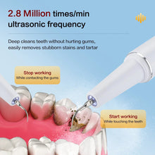 Load image into Gallery viewer, Dental Scaler Ultrasound Electric Tooth Cleaning Oral Care Plaque Removes Tartar Dental Scraper Dental Instrument