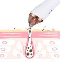 Load image into Gallery viewer, 4 in 1 Body Guasha Cupping Blackhead Remover Machine