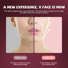 Load image into Gallery viewer, Microcurrent Face Massager EMS LED Photon Therapy V Shape
