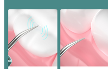 Load image into Gallery viewer, New High-definition Visual Dental Cleaner