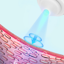 Load image into Gallery viewer, Visible Blackhead Acne Cleaning Machine