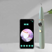 Load image into Gallery viewer, New High-definition Visual Dental Cleaner