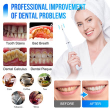 Load image into Gallery viewer, Electric Dental Calculus Remover Dental Cleaning Device Teeth Cleaner Tooth Whitening Irrigator Tartar Scaler Teeth Care