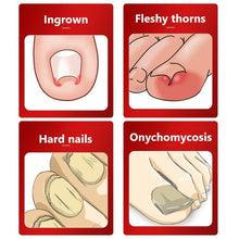 Load image into Gallery viewer, Dead Skin Dirt Remover Pedicure Care Tool Pro