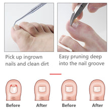 Load image into Gallery viewer, Dead Skin Dirt Remover Pedicure Care Tool