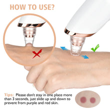 Load image into Gallery viewer, Electric Vacuum Suction Blackhead Remover Face Pore Vacuum Acne Pore Cleaner Pimple Removal Facial Skin Care Tools