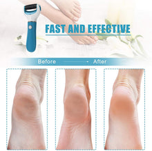 Load image into Gallery viewer, Electric USB Rechargeable Foot Grinder Heel File Grinding