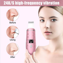 Load image into Gallery viewer, EMS Skin Scrubber Ultrasonic Facial Skin Spatula 36-42°C Heating Facial Cleansing Blackhead Remover Extractor Face Cleaning Tool