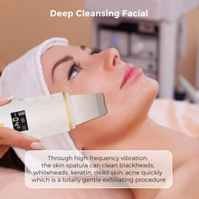 Load image into Gallery viewer, EMS Skin Scrubber Ultrasonic Facial Skin Spatula 36-42°C Heating Facial Cleansing Blackhead Remover Extractor Face Cleaning Tool