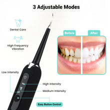 Load image into Gallery viewer, High Frequency Dental Teeth Whitening Electric Tooth Brush