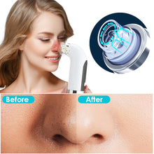 Load image into Gallery viewer, Vacuum Suction Rechargeable Face Nose Cleanser