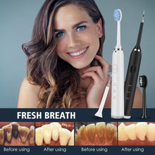 Load image into Gallery viewer, Electric Dental Scaler Teeth Whitening Device Teeth Cleaner