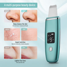 Load image into Gallery viewer, Ultrasonic Skin Scrubber EMS Facial Pore Deep Cleansing