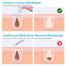 Load image into Gallery viewer, Facial Blackhead Remover Electric Acne Cleaner Device