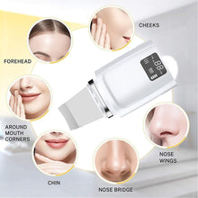 Load image into Gallery viewer, LCD Screen Peeling Machine Blackhead Remover Pore Cleaning and Care Facial Cleanser Household Beauty Instrument
