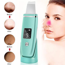 Load image into Gallery viewer, Ultrasonic Vibration Blackhead Remover Deep Cleansing