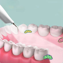 Load image into Gallery viewer, Ultrasonic Dental Scaler Electric Teeth Cleaning Tools Clean Tartar Smoke Stains Adult Oral 5 Mode Cleaning Care Tools
