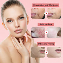Load image into Gallery viewer, 7 In 1 RF Face Massager Skin Rejuvenation Mesotherapy Facial Lifting LED Phototherapy Wrinkle Remover Beauty Vibration Device
