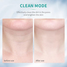 Load image into Gallery viewer, 3 Colors Led Facial Neck Massager Photon Skin Tighten Slimming Reduce Double Chin Anti Wrinkle Face Neck Lift Machine
