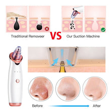 Load image into Gallery viewer, Vacuum Blackhead Remover Pimple Acne Removal Tool Skin Care Pore Cleaner Facial Diamond Dermabrasion Machine
