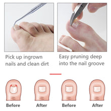 Load image into Gallery viewer, Toe Nail Clippers Nail Correction Thick Nails Ingrown Toenails Nippers Cutters Dead Skin Dirt Remover Pedicure Care Tool
