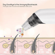 Load image into Gallery viewer, 4 In 1 Blackhead Remover Rechargeable Vacuum Suction Warmer Blackhead Acne Comedo Extractor Facial Cleanser Beauty Machine
