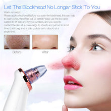 Load image into Gallery viewer, Vacuum Blackhead Remover Pimple Acne Removal Tool Skin Care Pore Cleaner Facial Diamond Dermabrasion Machine
