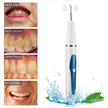 Load image into Gallery viewer, Portable Ultrasonic Dental Scaler Tooth Calculus Remover Tooth Stains Tartar Tool Dentist Teeth Whitening Oral Hygiene Tools
